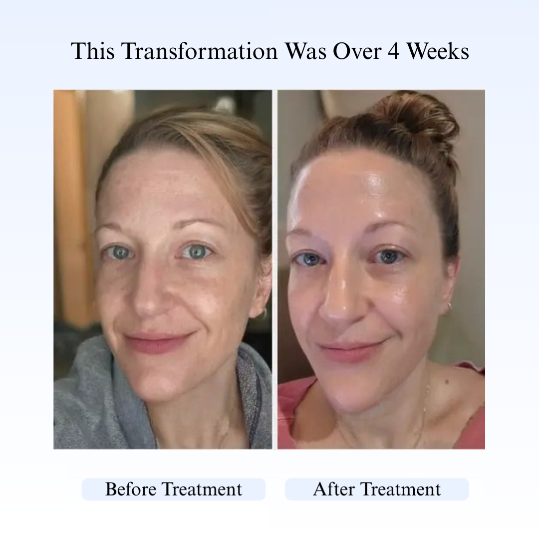 Dr.Melaxin Peel Shot Combo (For black & Whiteheads)